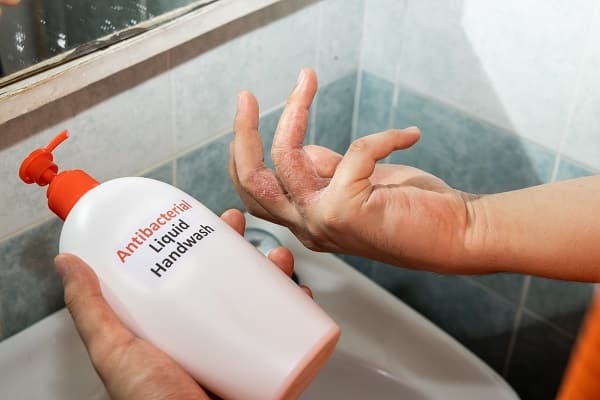 Dermatitis