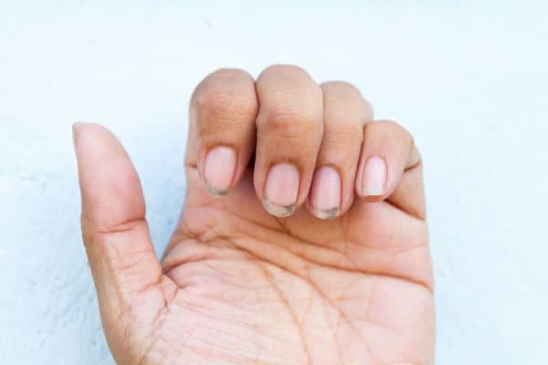 Nail Health