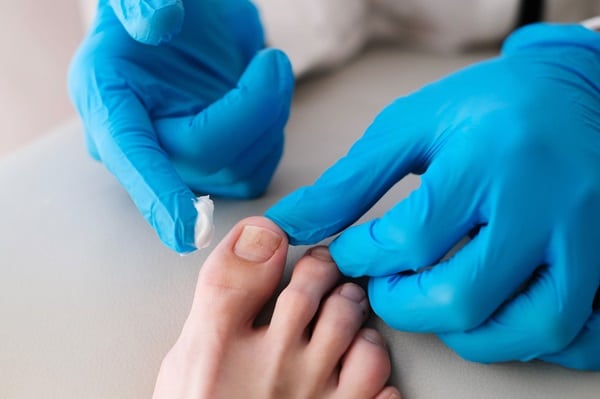 Nail Health