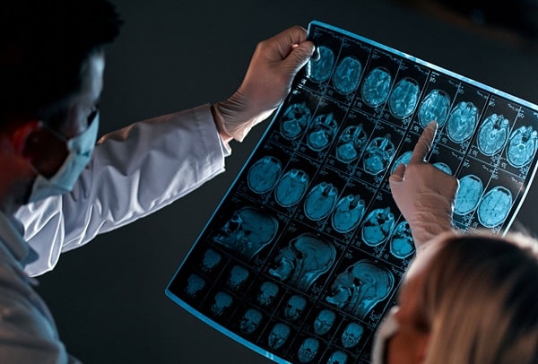 Encephalitis
