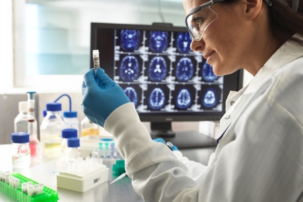 Risk of Alzheimer’s Disease