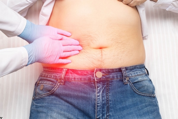 The Silent Threat of Gallstones