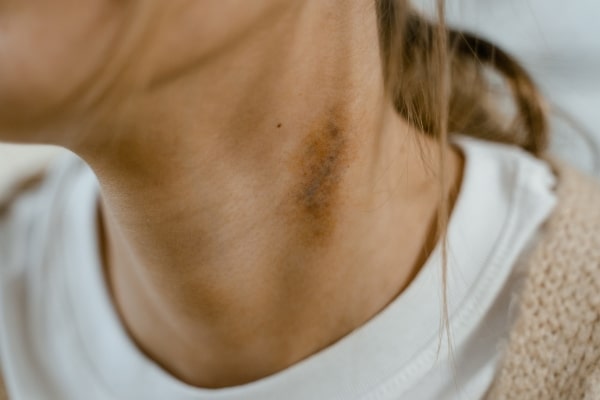 Early Signs of Prediabetes