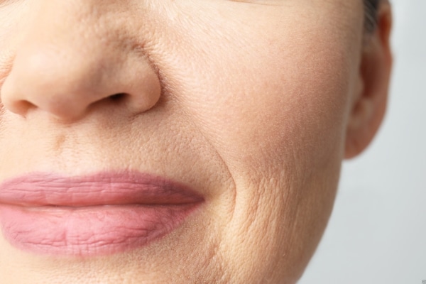 Wrinkles Reveal About Your Health!